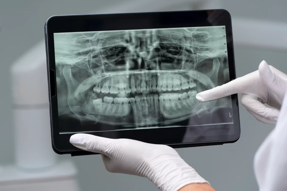 Imagen de una tablet con una radiografía de un paciente