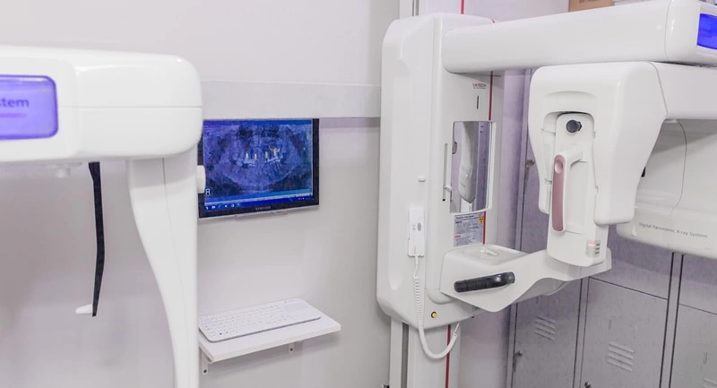 implantes dentales 