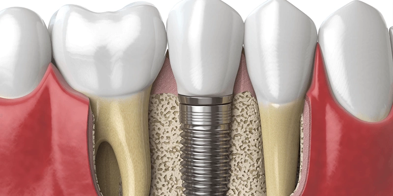Iván Nogueira - Odontólogo especialista en Zaragoza