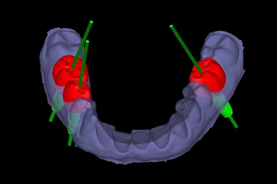 Planificación digital